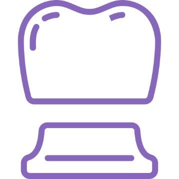 Implantes dentista Alcoy