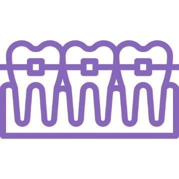 Ortodoncia-en-Benetusser