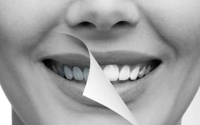 Dientes amarillos