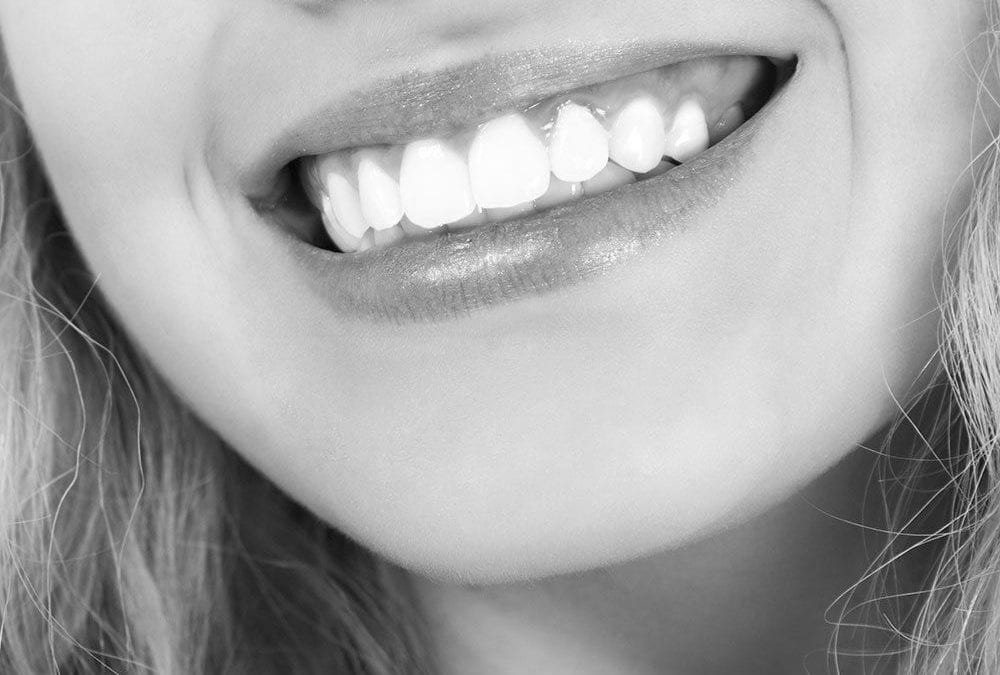 Blanquear los dientes: 7 motivos para hacerlo
