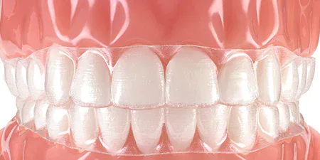 alineadores transparentes