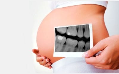 🤰Embarazo y tratamientos dentales: Todo lo que necesitas saber