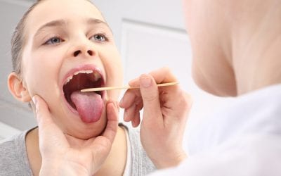 Cómo prevenir los cálculos amigdalinos