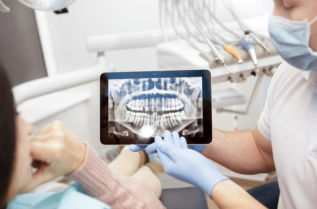 Cuidado de los implantes dentales: Consejos y trucos