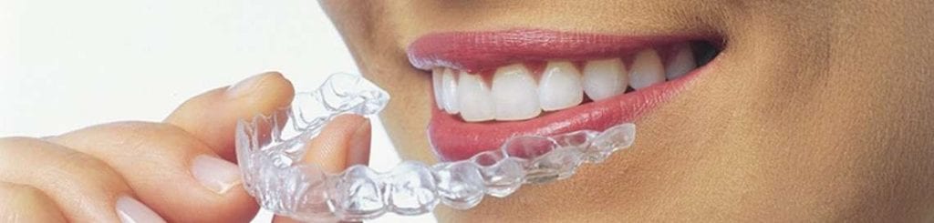 mercado de la ortodoncia invisible