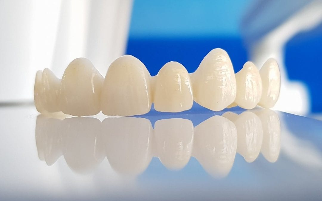10 ventajas de las coronas de zirconio