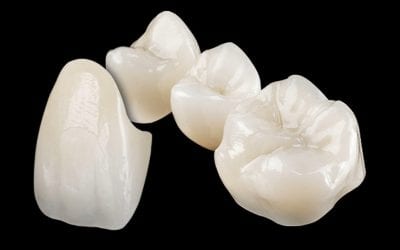 ¿Qué tipo de corona de zirconio es mejor?