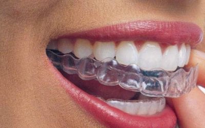 Férulas de descarga