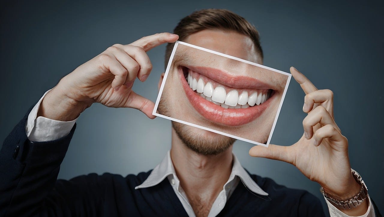 promociones en carillas dentales