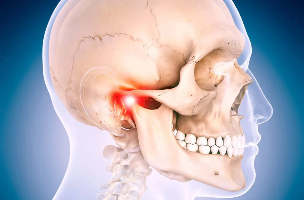 Causas de la Articulación temporomandibular