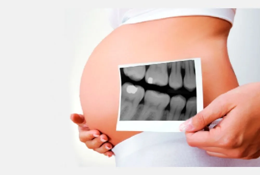 🤰Embarazo y tratamientos dentales: Todo lo que necesitas saber