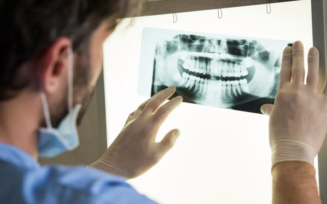 Conoce todo sobre la radiografía dental