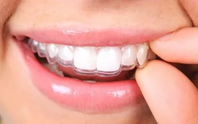 Vitalcoy Ortodoncia invisible en Alcoy opiniones