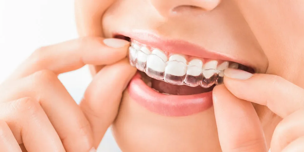 Consejos nuevos pacientes invisalign