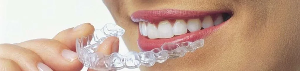 mercado de la ortodoncia invisible