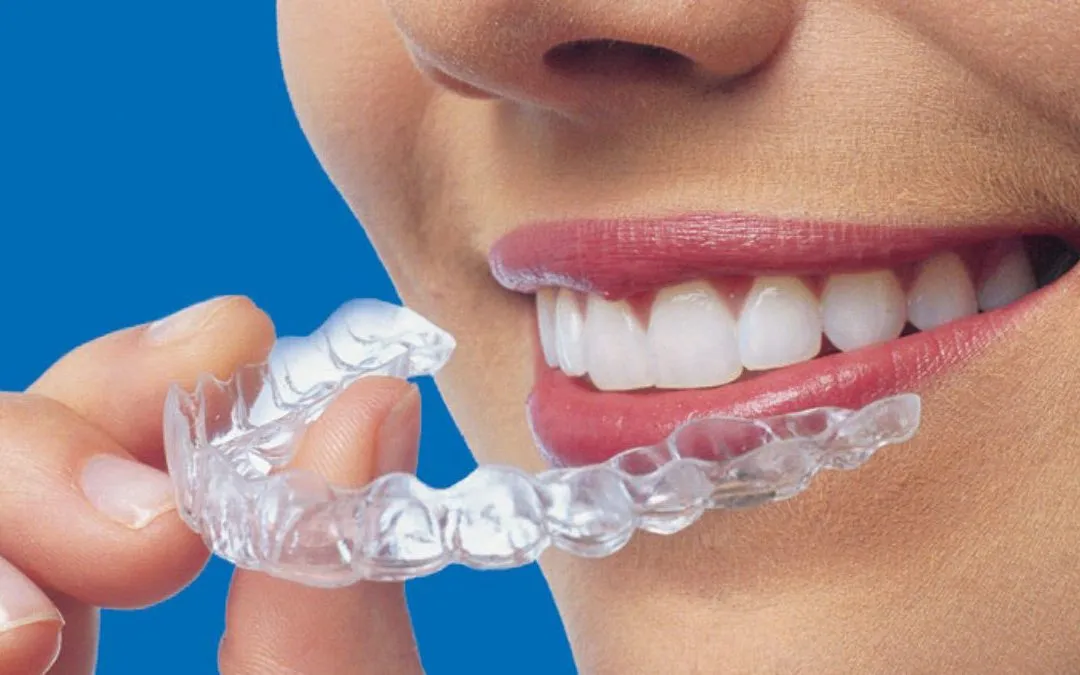 El mercado de la ortodoncia invisible