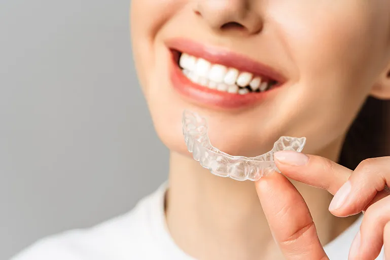 ¿Qué son los accesorios Invisalign y cómo mejoran el tratamiento de ortodoncia?