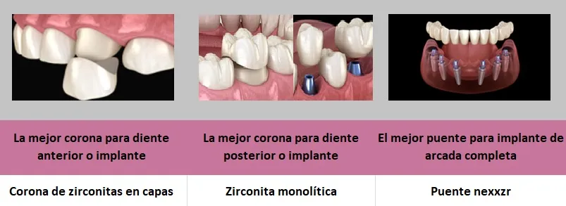 Tipos de coronas de zirconio