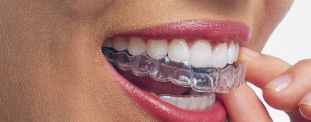 Férulas de descarga