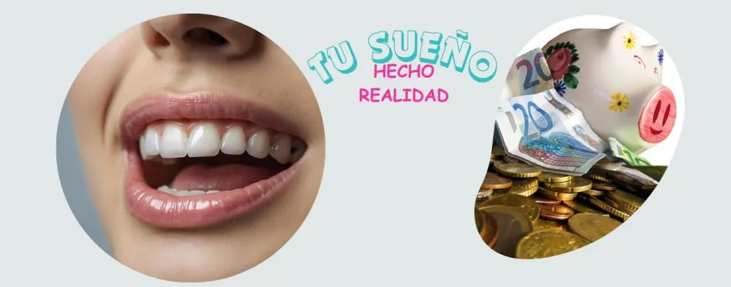 FINANCIACIÓN DE CARILLAS DENTALES