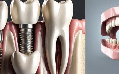 Guía para el cuidado de Prótesis Dentales