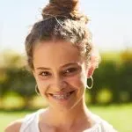 Brackets vs Invisalign