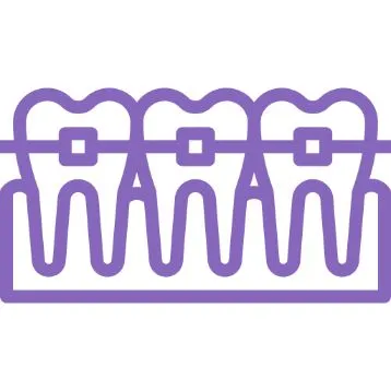 Ortodoncia-en-Benetusser